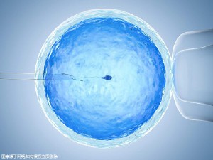 生殖中心环境